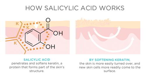 Salicylic Acid hoạt động trên da như thế nào?