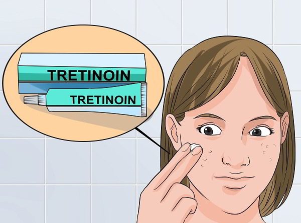 tretinoin