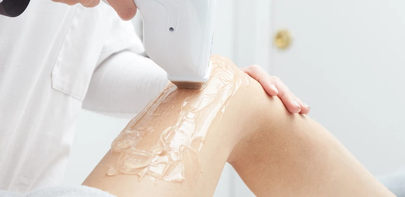 Cách lựa chọn máy triệt lông mini để cá nhân dùng ngay tại nhà