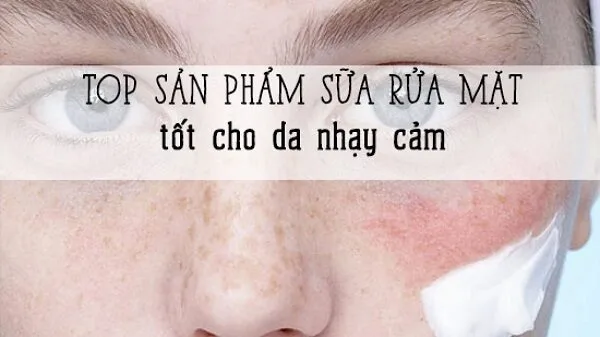 sữa rửa mặt dịu nhẹ cho da nhạy cảm
